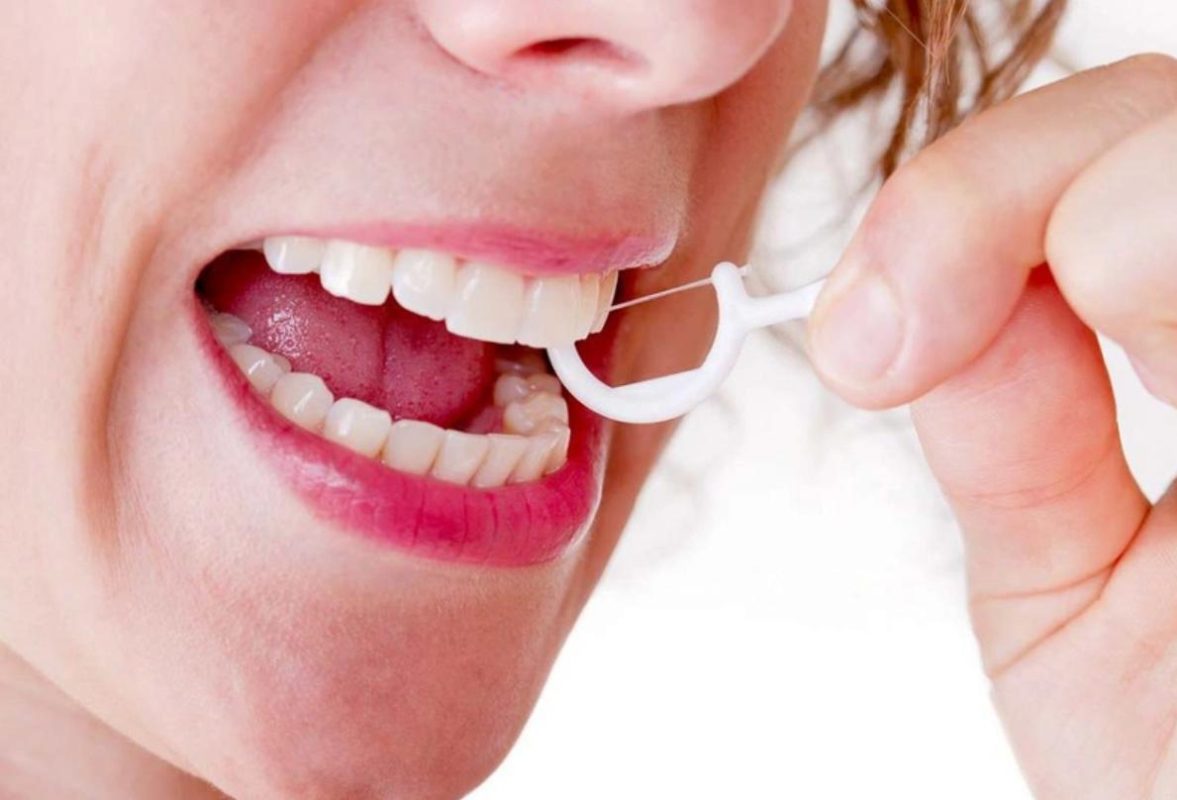 tăm chỉ nha khoa loại nào tốt