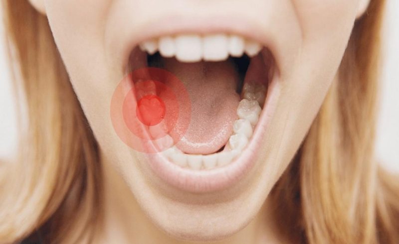 Yếu tố ảnh hưởng đến mức độ đau nhức sau trồng răng