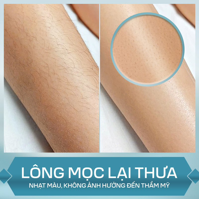 Mạ Beauty - Spa triệt lông uy tín TPHCM