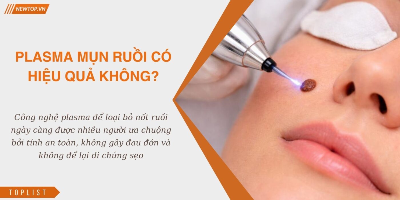 plasma mụn ruồi