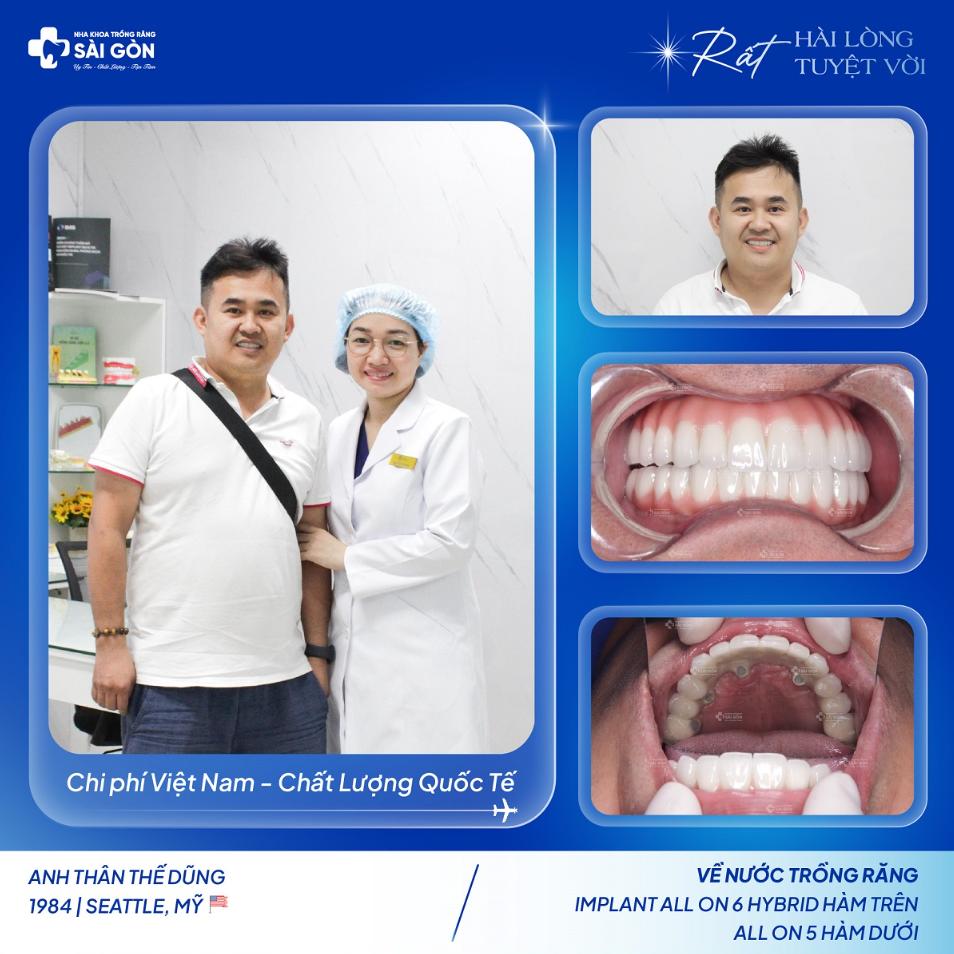 Khách hàng trồng răng implant tại Nha Khoa Trồng Răng Sài Gòn